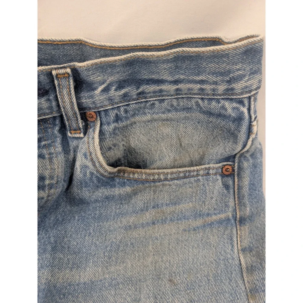 Levis stains discoloration